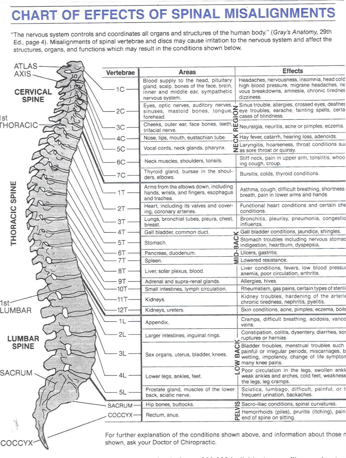 Spinal Misalignments Chart